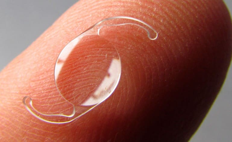 Lente intraocular pode ser negada por seu plano de saúde? Artigo 'Lente intraocular pode ser negada por seu plano de saúde?'