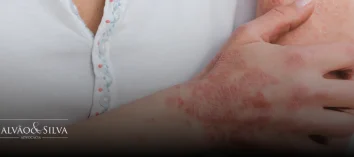Doença de Lyme: veja como garantir seus direitos legais