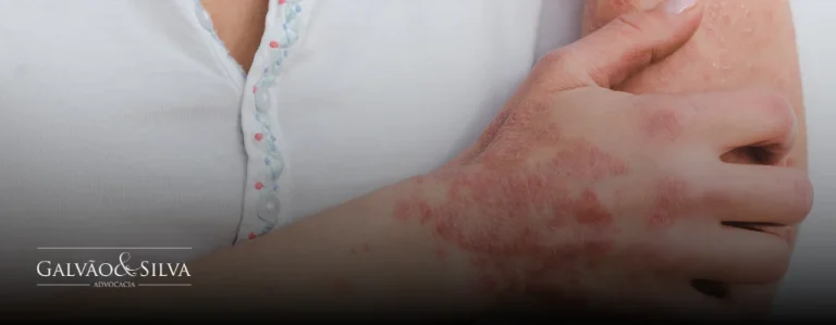 Doença de Lyme: veja como garantir seus direitos legais