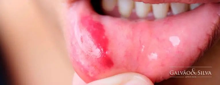 E se eu Cometer o Crime de Lesão Corporal? O que Acontece?